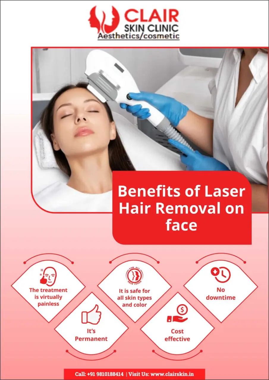 Facial laser hair removal