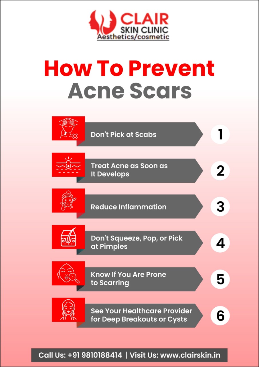 Acne Scar Removal: Types, Causes, And Treatment At Clair Skin Clinic