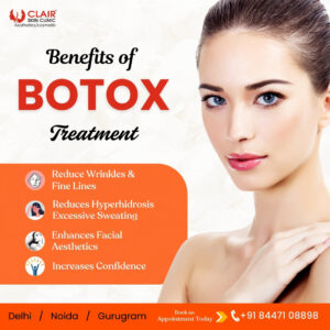 Botox Treatment