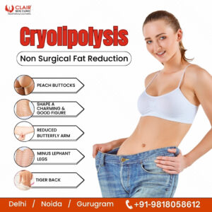 Cryolipolysis Treatment