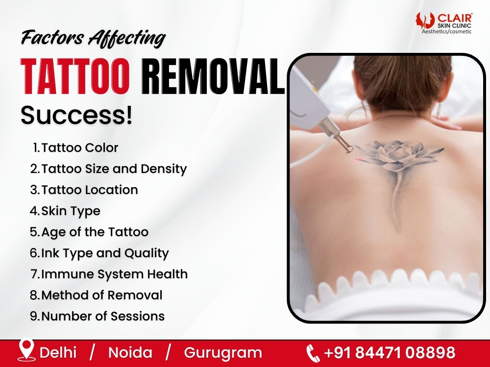 Factors Affecting Tattoo Removal Success