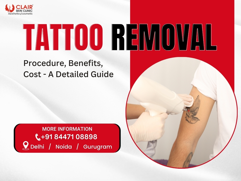 Tattoo Removal Procedure, Benefits, Cost