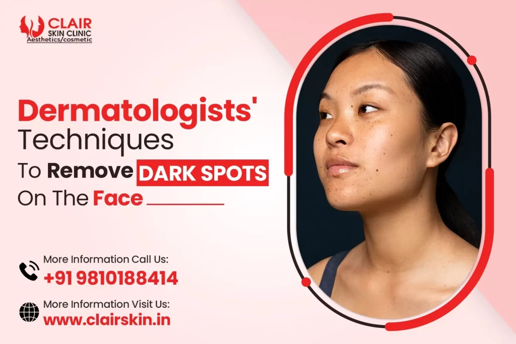 Dermatologists Techniques To Remove Dark Spots On The Face