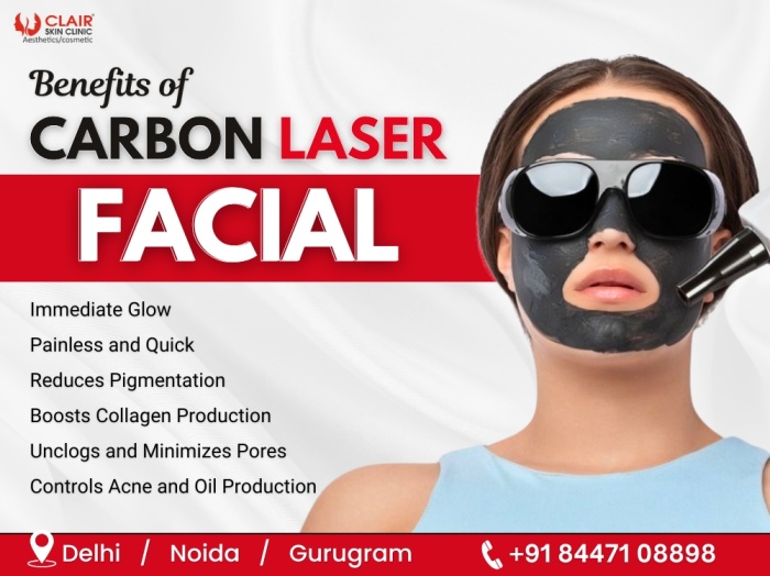 Benefits of Carbon Laser Facial