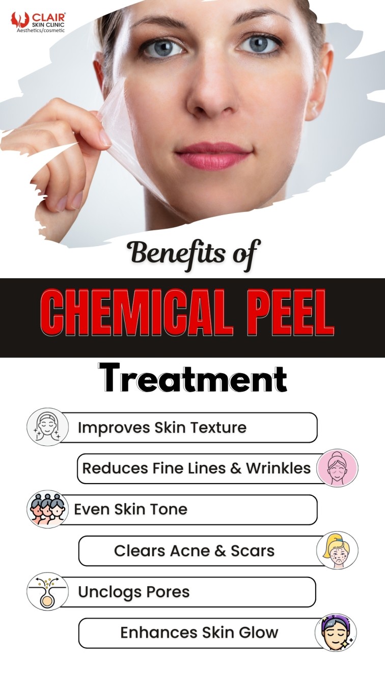 Benefits of Chemical Peel Treatment