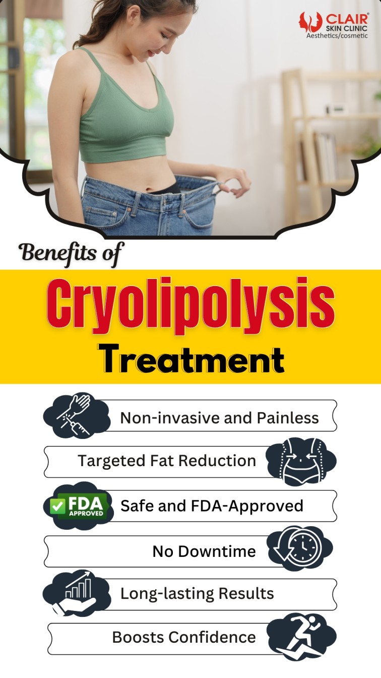 Benefits of Cryolipolysis Treatment