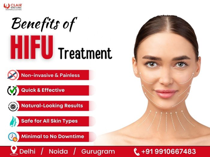 Benefits of HIFU Treatment