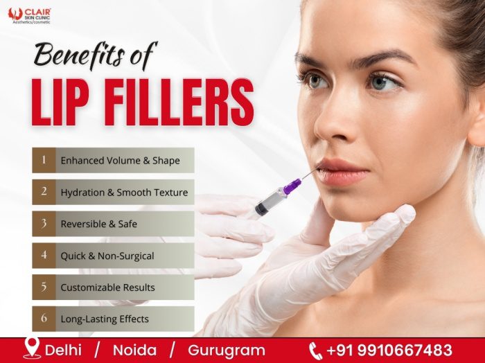 Benefits of Lip Fillers