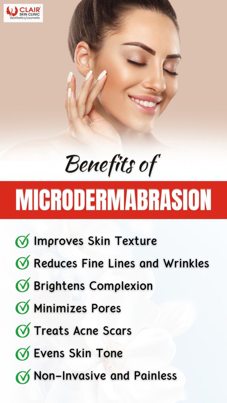 Benefits of Microdermabrasion