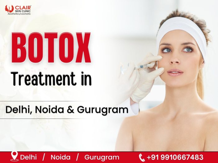 Botox Treatment in Delhi, Noida & Gurugram