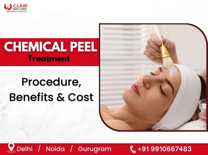 Chemical Peel Treatment Procedure, Benefits & Cost