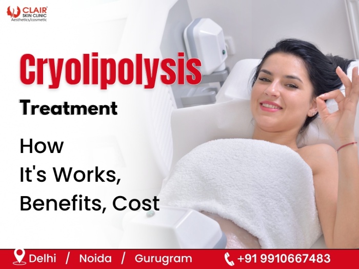 Cryolipolysis Treatment- How It's Works, Benefits, Cost