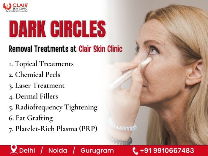 Dark Circles Removal Treatments at Clair Skin Clinic