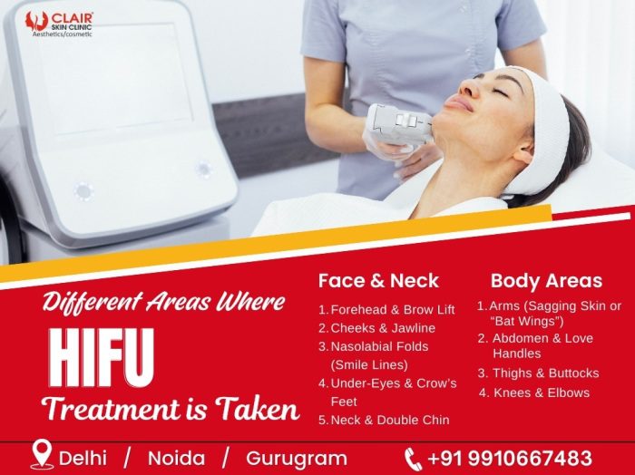 Different Areas Where HIFU Treatment is Taken