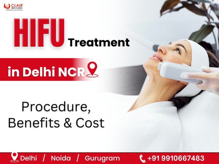 HIFU Treatment in Delhi NCR- Procedure, Benefits & Cost