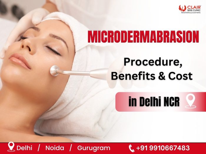 Microdermabrasion Procedure, Benefits & Cost in Delhi NCR