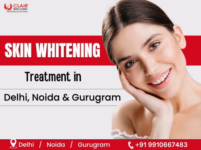 Skin Whitening Treatment in Delhi, Noida & Gurugram