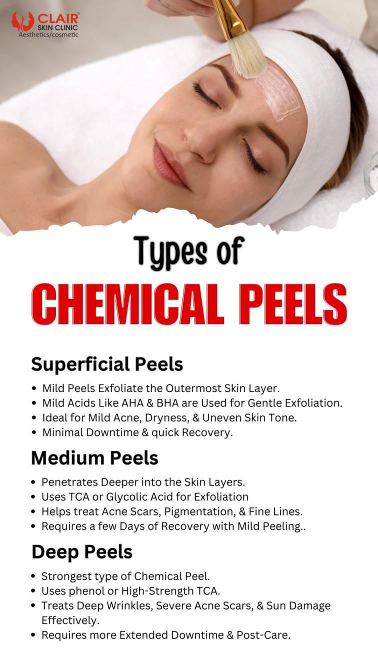 Types of Chemical Peels