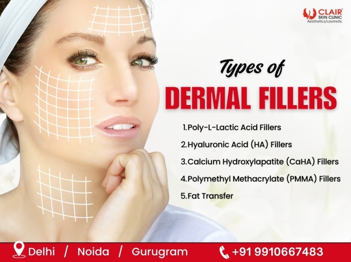 Types of Dermal Fillers