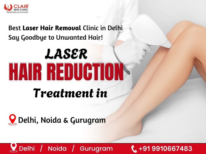 Laser Hair Reduction Treatment in Delhi