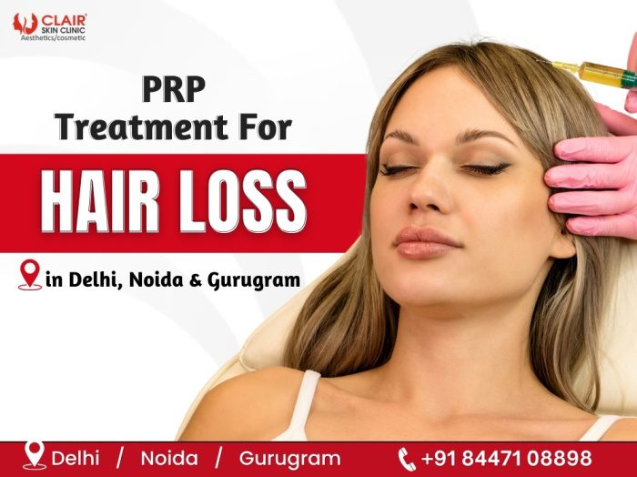 PRP Treatment For Hair Loss in Delhi