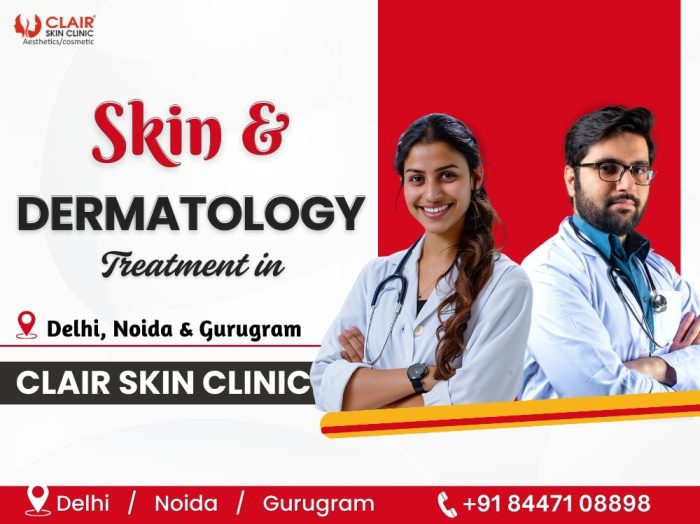 Skin & Dermatology Treatment in Delhi NCR